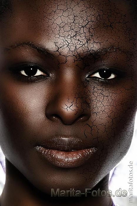 Edem